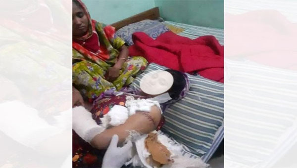 প্রেমের প্রস্তাবে রাজি না হওয়ায় তরুণীর স্তন কেটে দিলো বখাটে