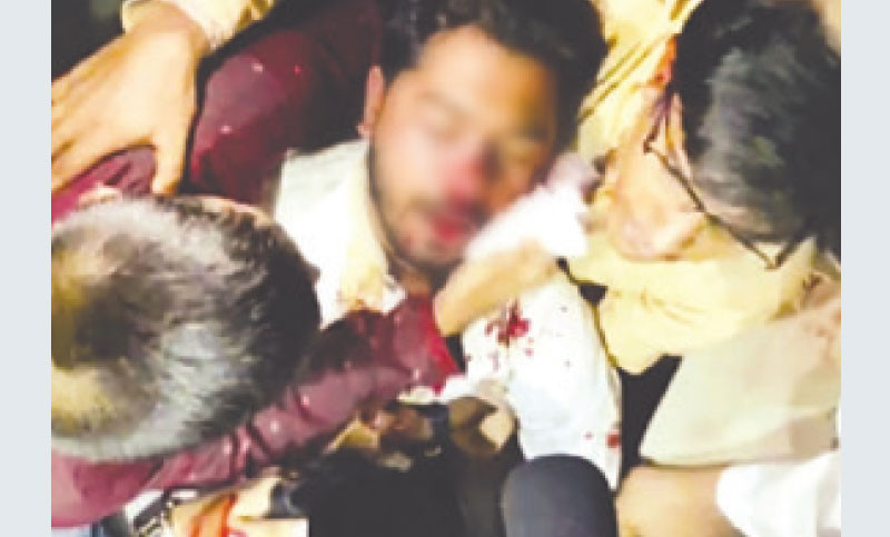নুরের নাক ও চোখে আঘাতের চিহ্ন